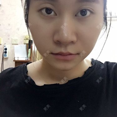 权志琳