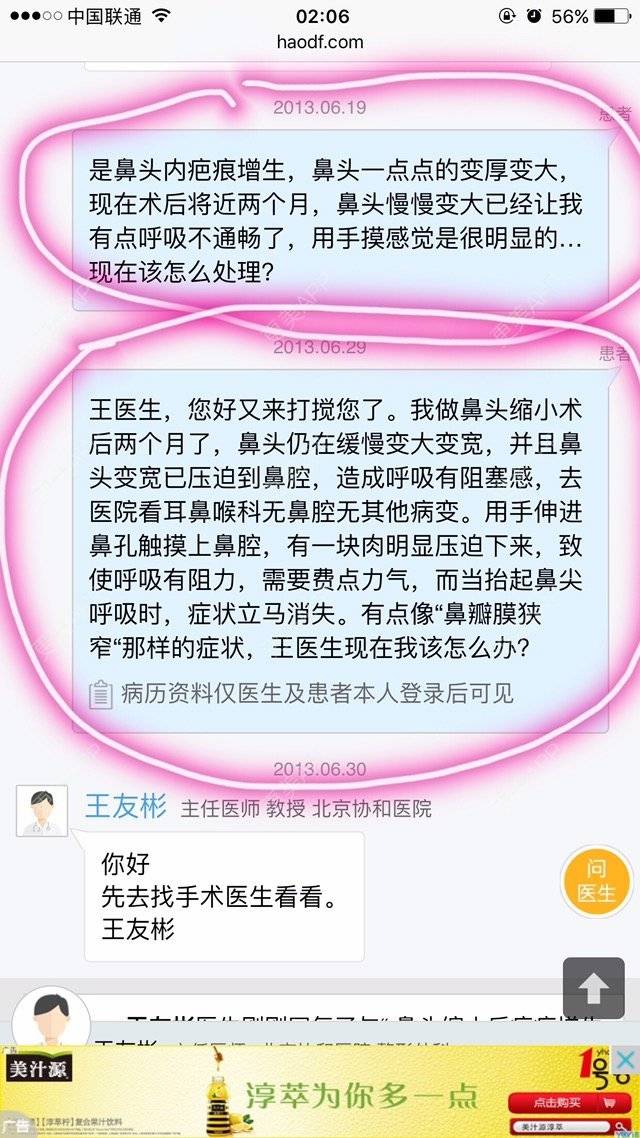 更美 - 权志琳的经验 | 鼻部整形 | 鼻部多项 | 鼻翼鼻头缩小 | 广州