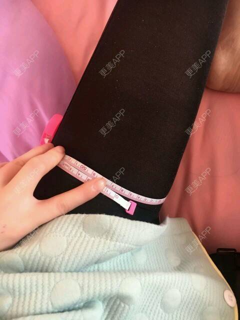 更美 - 辉辉辉-辉的吸脂瘦大腿经验 | 美购日记 | 腿部吸脂 | 吸脂瘦大腿 | 重庆