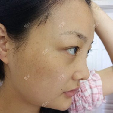爱美美眉