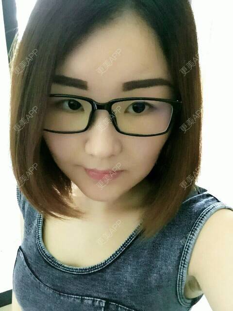 更美 - 李军 医生的自体脂肪全面部填充经验 | 美购日记 | 自体脂肪全面部填充 | 广州