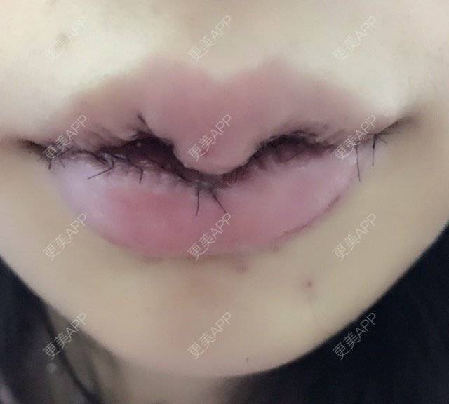 更美用户sepnxpqvyw的唇形日记