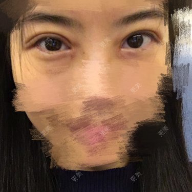更美用户xkRcLM3DQQ