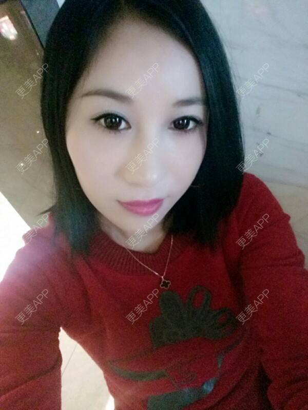 更美 - 更美用户Rgf5OmHSOo的自体脂肪全面部填充经验 | 美购日记 | 自体脂肪全面部填充 | 武汉