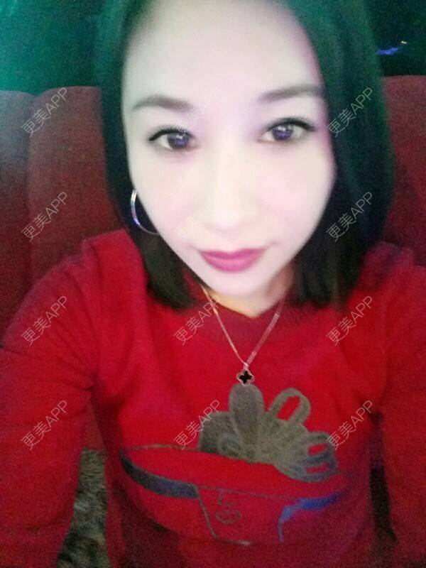 更美 - 更美用户Rgf5OmHSOo的自体脂肪全面部填充经验 | 美购日记 | 自体脂肪全面部填充 | 武汉