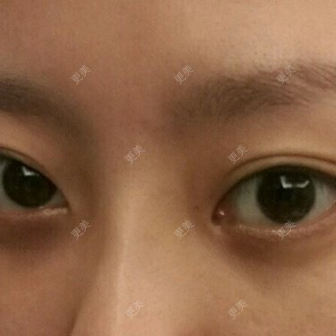 兔小妖要更美