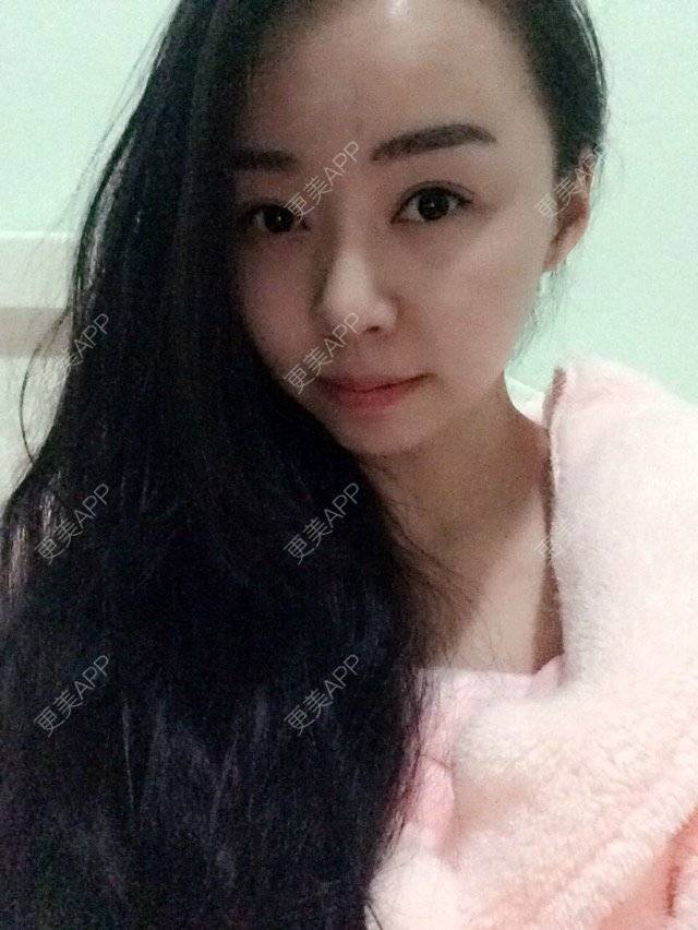 更美 - 吾皇11的经验 | 皮肤管理 | 重庆
