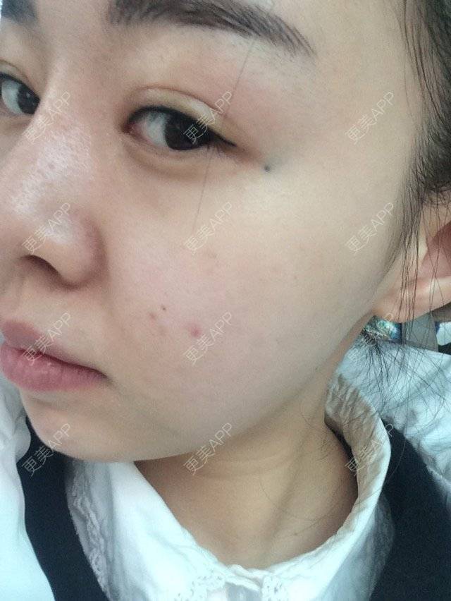 更美 - 吾皇11的经验 | 皮肤管理 | 重庆