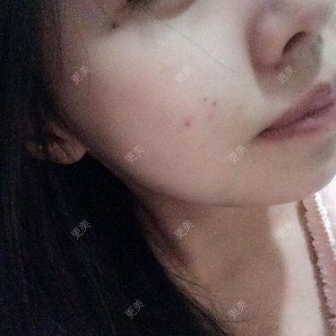 吾皇11