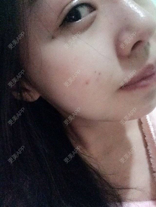 更美 - 吾皇11的经验 | 皮肤管理 | 重庆