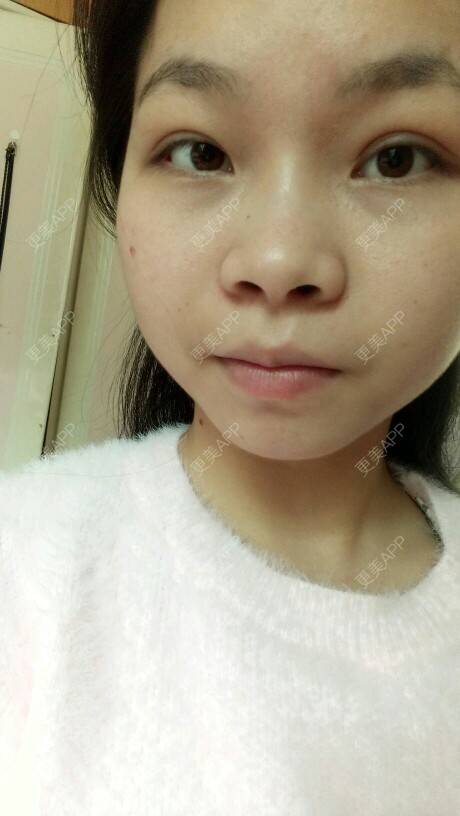 更美 - 啊小恋的经验 | 太阳穴凹还是颧骨高 | 深圳