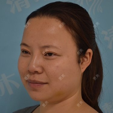 小小眉