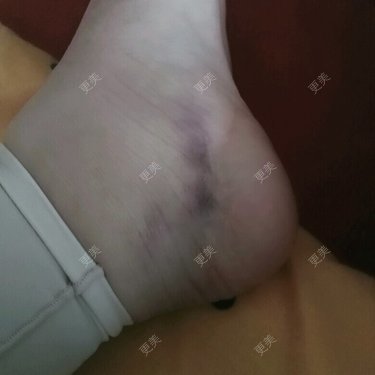 我要变成铅笔腿
