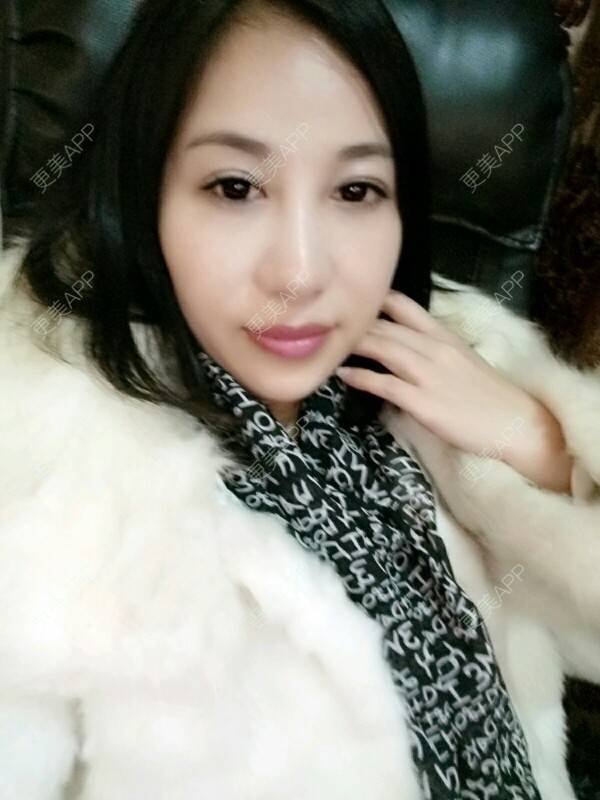 更美 - 更美用户Rgf5OmHSOo的自体脂肪全面部填充经验 | 美购日记 | 自体脂肪全面部填充 | 武汉