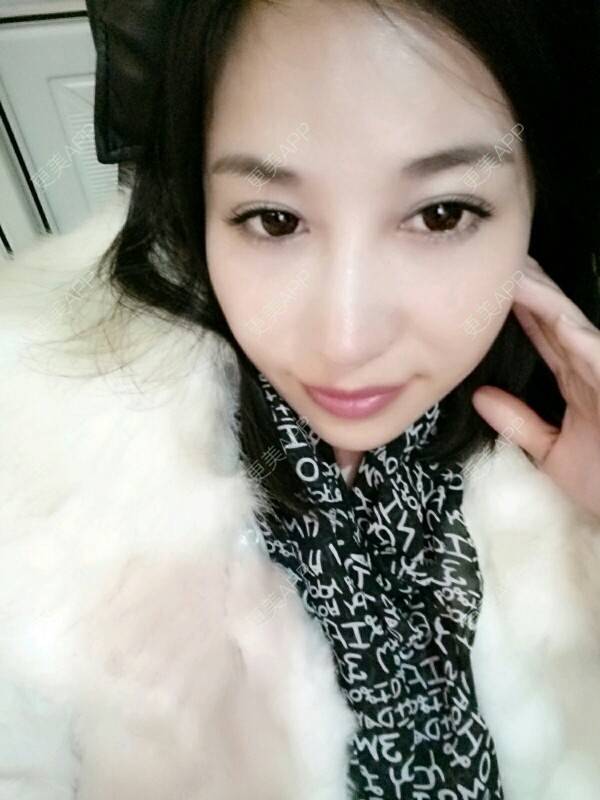 更美 - 更美用户Rgf5OmHSOo的自体脂肪全面部填充经验 | 美购日记 | 自体脂肪全面部填充 | 武汉