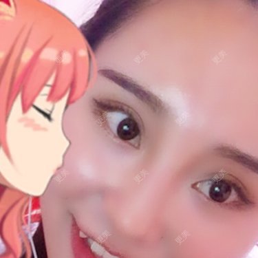 嘴角上提