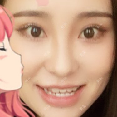 嘴角上提