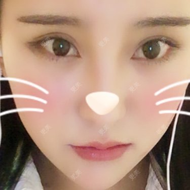 嘴角上提