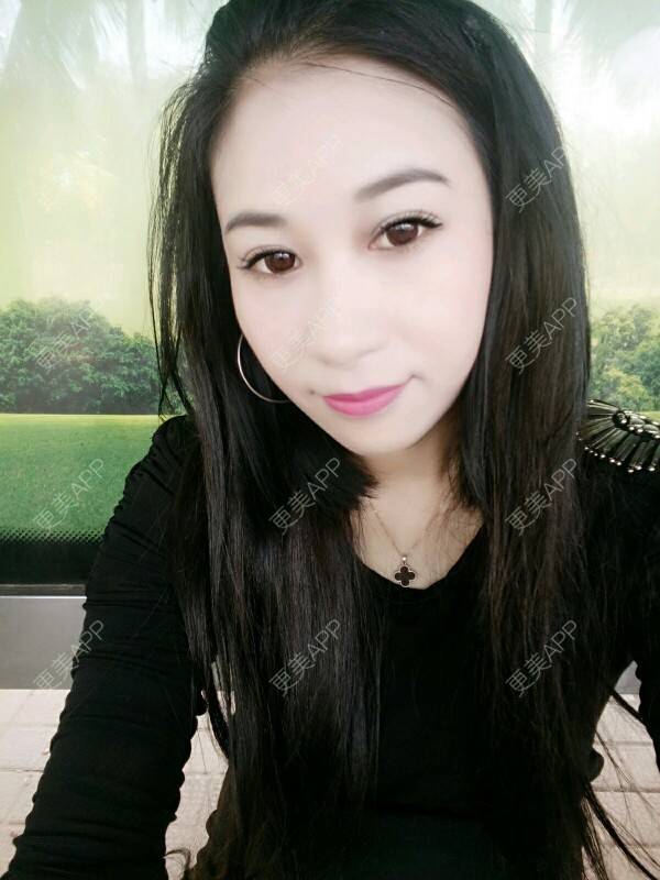 更美 - 更美用户Rgf5OmHSOo的自体脂肪全面部填充经验 | 美购日记 | 自体脂肪全面部填充 | 武汉