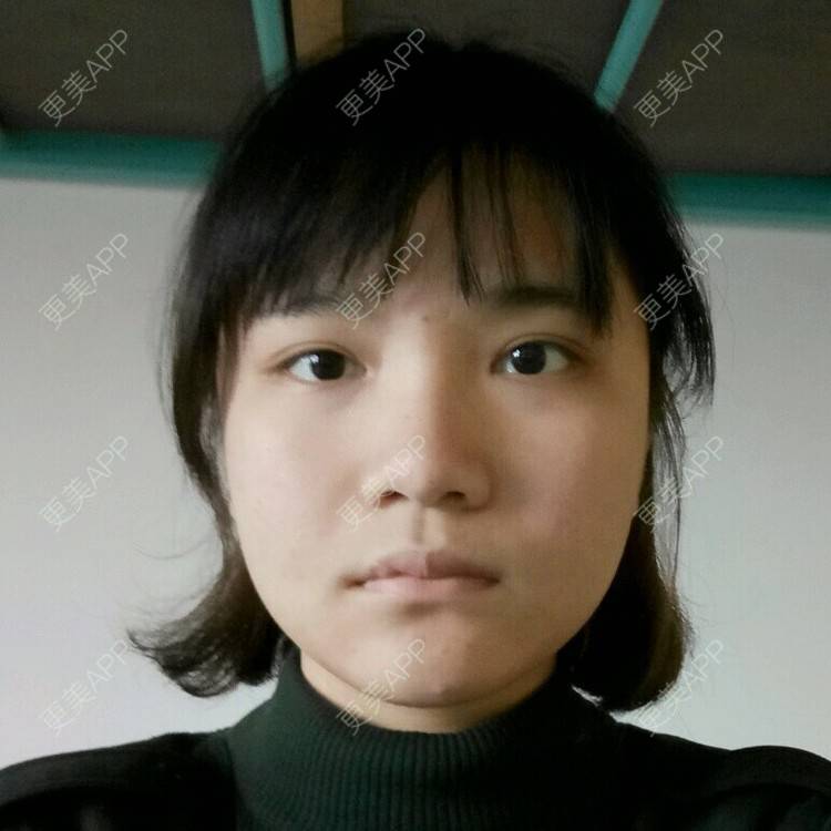 更美 - ugi的经验 | 自体脂肪填充面部手术 | 长沙