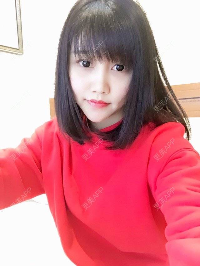 更美 - 桃哥哥 🚶🏼的经验 | 缩小鼻头鼻翼 | 鼻综合手术 | 镇江