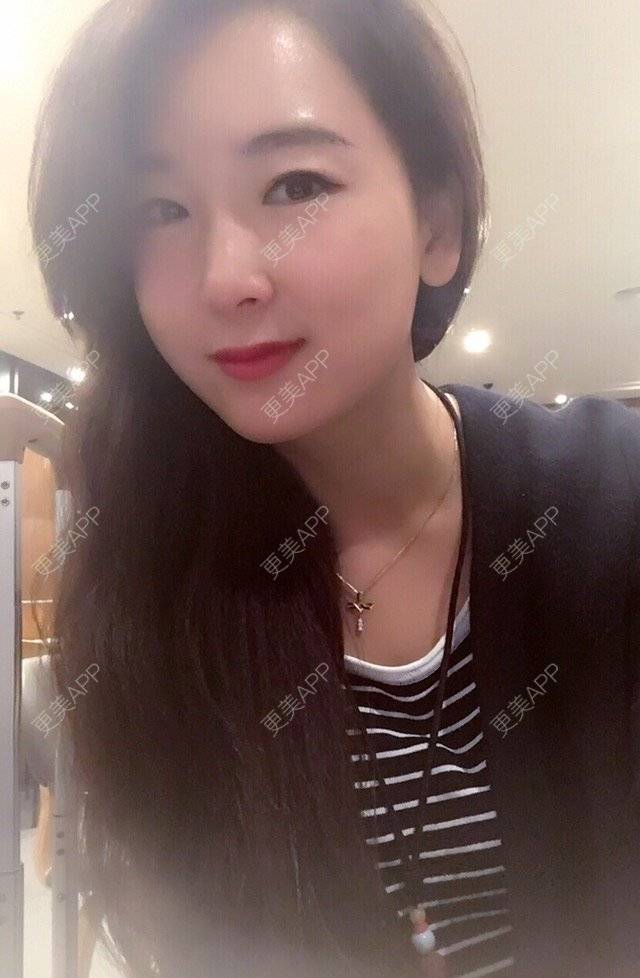 更美 - 柳青老师的丰耳垂经验 | 丰耳垂 | 青岛