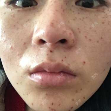 一粒一