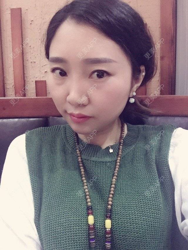 更美 - 💓___jenny💋👣的经验 | 外切去眼袋 | 深圳
