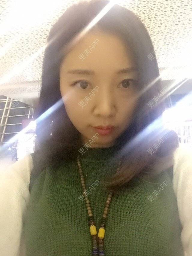 更美 - 💓___jenny💋👣的经验 | 外切去眼袋 | 深圳