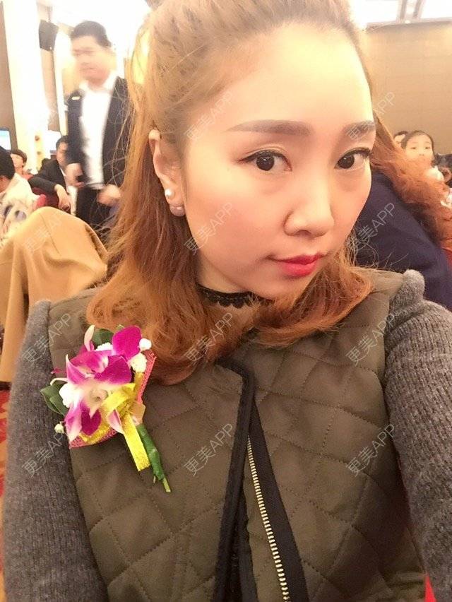 更美 - 💓___jenny💋👣的经验 | 外切去眼袋 | 深圳