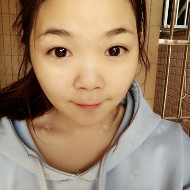 Yliyu