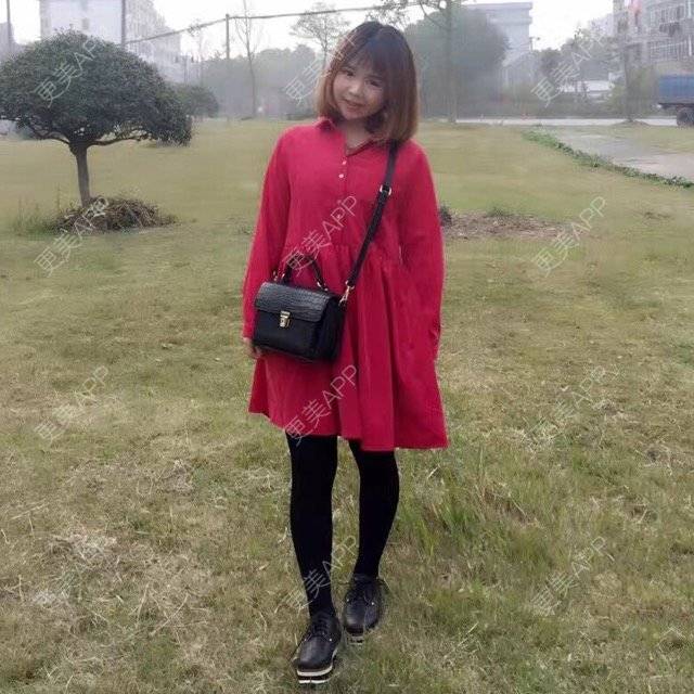 更美 - 宝宝美美哒的吸脂经验 | 吸脂瘦腿 | 臀部吸脂手术 | 吸脂 | 美购日记 | 重庆