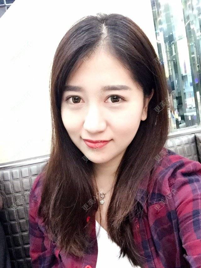 更美 - 大长腿欧尼的吸脂瘦脸经验 | 美购日记 | 吸脂瘦脸 | 双下巴吸脂 | 武汉