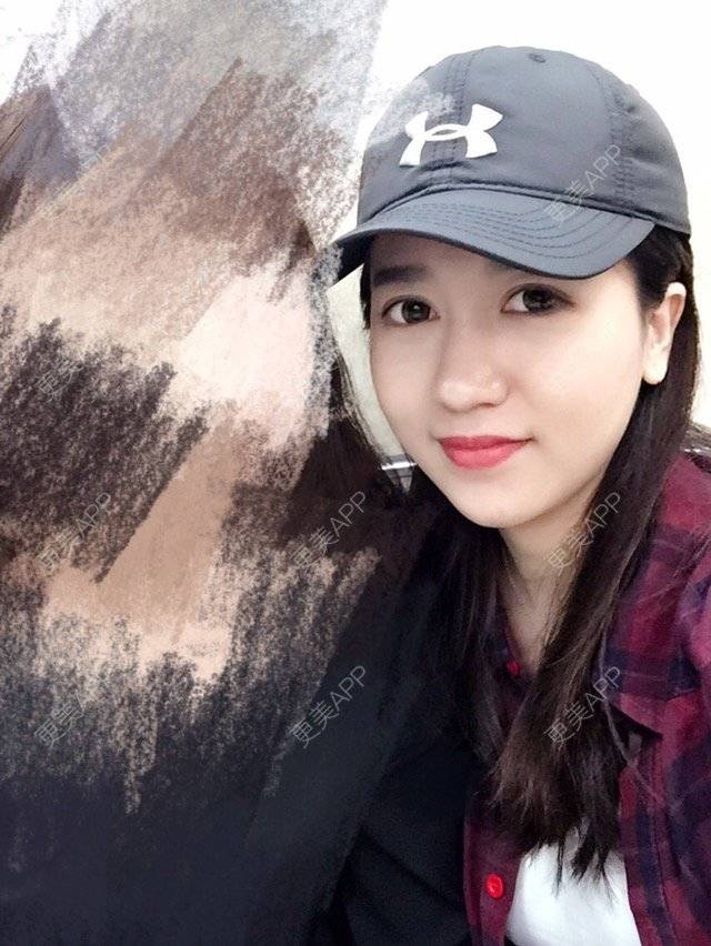 更美 - 大长腿欧尼的吸脂瘦脸经验 | 美购日记 | 吸脂瘦脸 | 双下巴吸脂 | 武汉