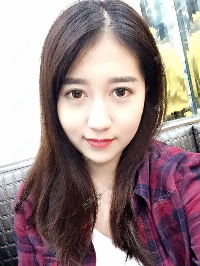 更美 - 大长腿欧尼的吸脂瘦脸经验 | 美购日记 | 吸脂瘦脸 | 双下巴吸脂 | 武汉