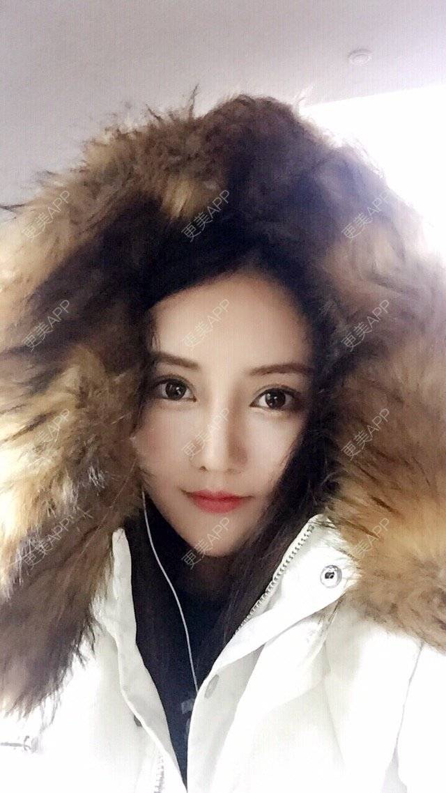 更美 - 比比芭比波比OAO的果酸焕肤经验 | 果酸焕肤 | 天津 | 自体脂肪丰太阳穴额头 | 美白