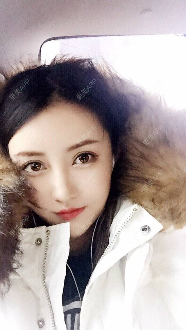 更美 - 比比芭比波比OAO的果酸焕肤经验 | 果酸焕肤 | 天津 | 自体脂肪丰太阳穴额头 | 美白