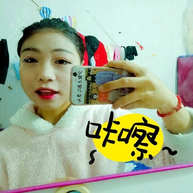 更美 - A要爆炸啦的经验 | 激光溶脂瘦脸 | 青岛