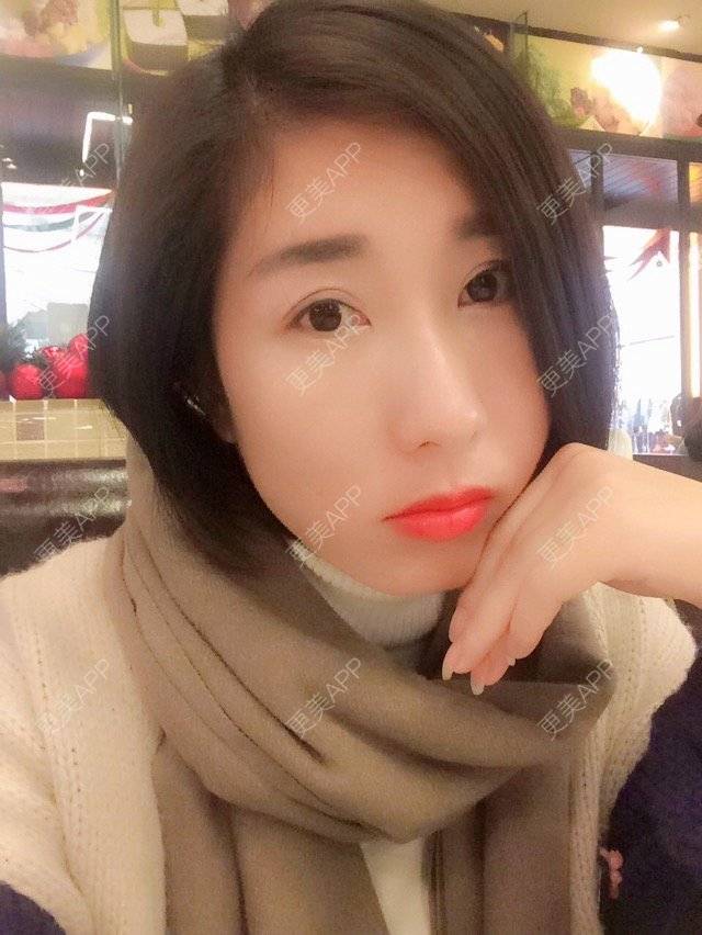 更美 - 爱美的丸子o的半永久纹眼线经验 | 上海 | 半永久纹眼线