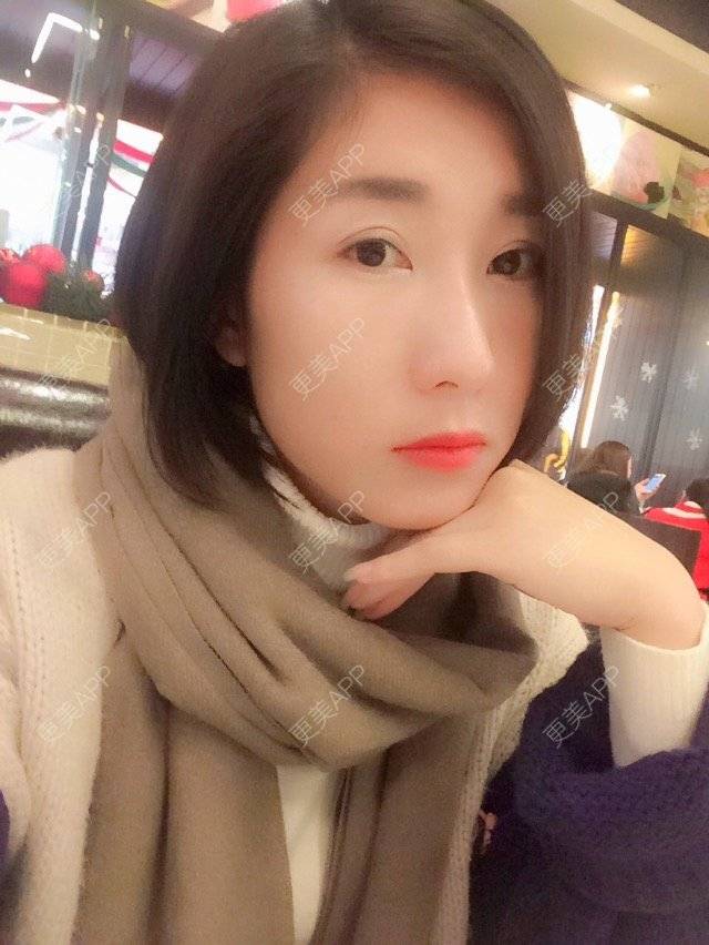 更美 - 爱美的丸子o的半永久纹眼线经验 | 上海 | 半永久纹眼线