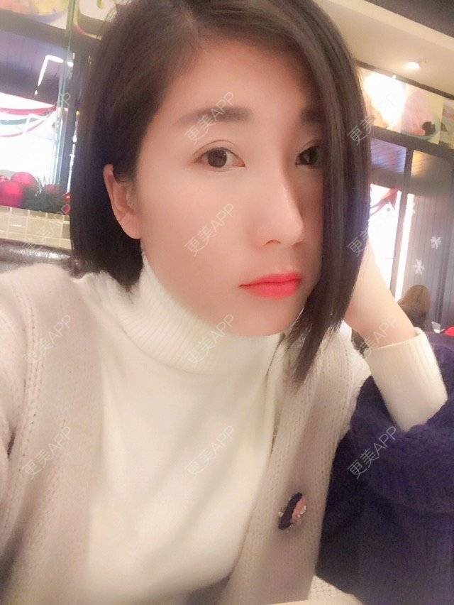 更美 - 爱美的丸子o的半永久纹眼线经验 | 上海 | 半永久纹眼线