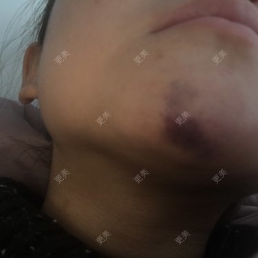 蕾洛