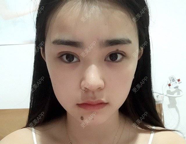 更美 - play play的经验 | 改脸型 | 嘉兴