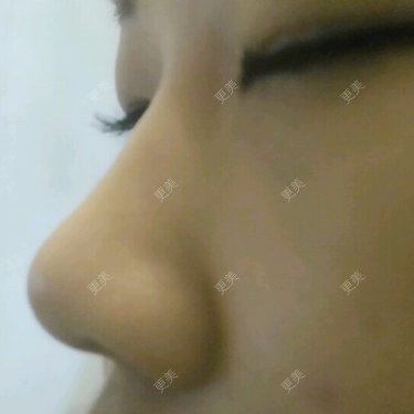 A.择优从善.