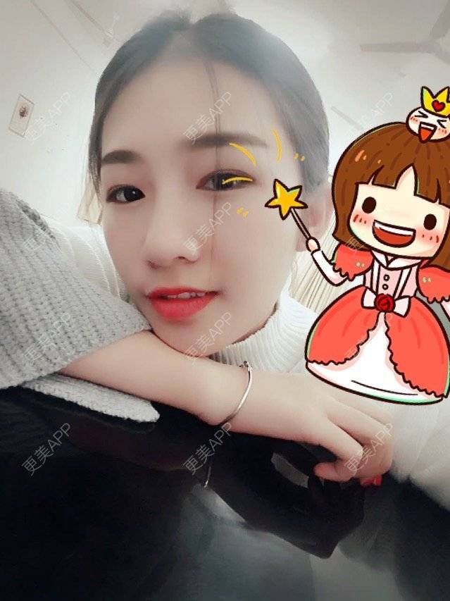更美 - 杰西卡cici的牙齿矫正经验 | 美购日记 | 牙齿矫正 | 口腔齿科 | 美呀隐形矫正 | 北京