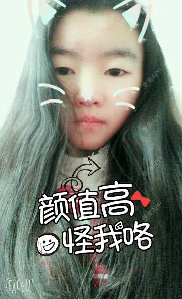 更美 - ♛凉城♀晨曦的经验 | 北京 | 近视镜片矫正
