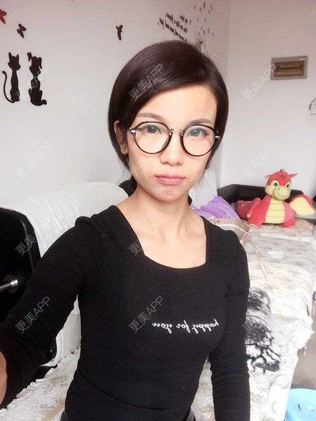 更美 - 猫忘了鱼尾纱🐬的经验 | 打瘦脸针 | 庆阳