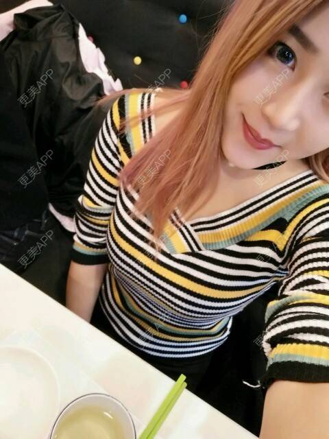更美 - 更美用户axRq2dlTG2的经验 | 酒窝成形 | 重庆