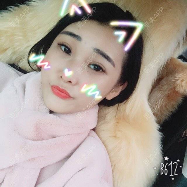 小倩倩要长大的自体脂肪全面部填充日记