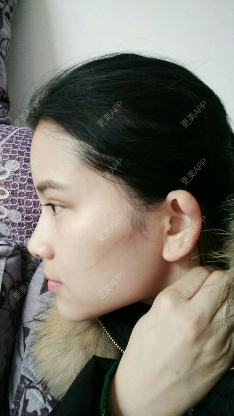更美 - 洁儿888的经验 | 招风耳矫正 | 常德